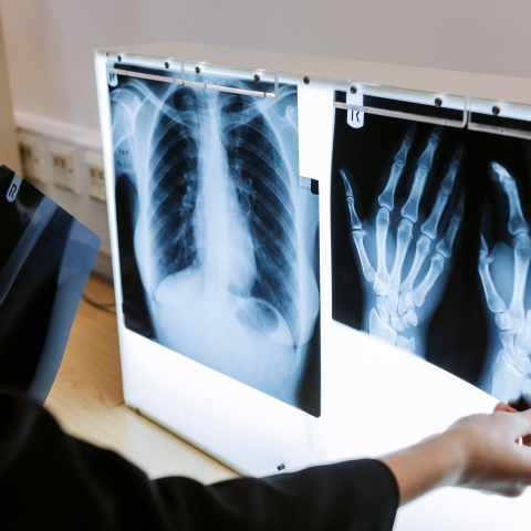 X-rays displayed on a lightbox