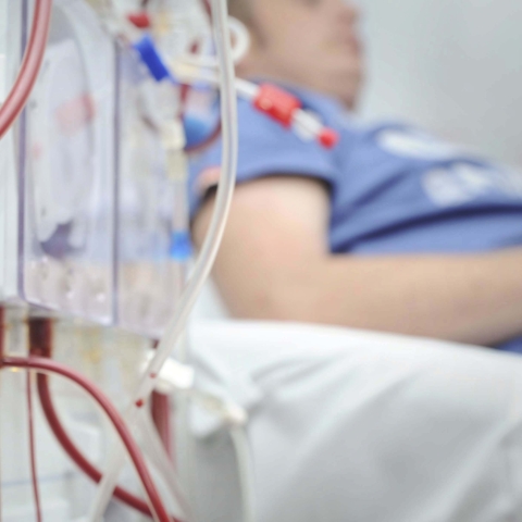 A patient on a renal dialysis machine