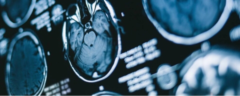 An MRI scan. BSc (Hons) Diagnostic Radiography and Medical Imaging.