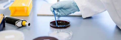 Close up of a gloved hand and some petri dishes
