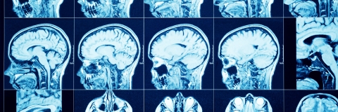 STANDARD LICENSE; PLEASE SEE ADDITIONAL ASSET FOR FULL LICENSE TERMS.