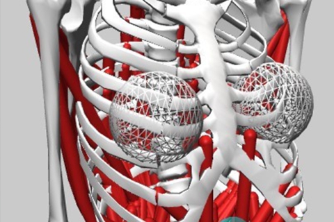 Breast health simulation